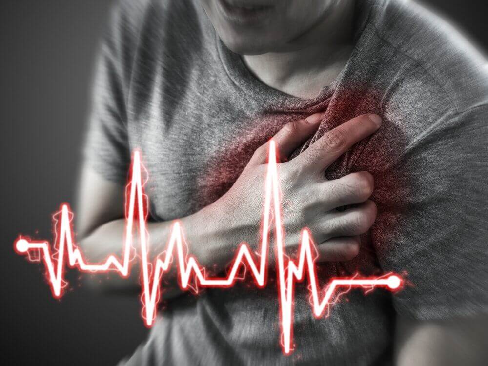 Sydäninfarktin oire