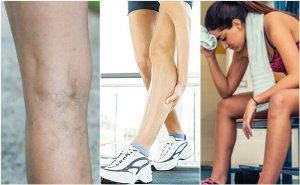 Mistä suonenveto johtuu? 6 mahdollista syytä