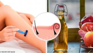 5 luontaishoitoa ihoärsytykseen karvojen ajelun jälkeen