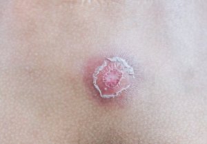 Paiseiden hoito 7 kotivinkin avulla