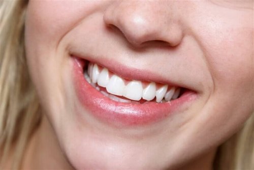 Aloe vera hoitaa hampaiden terveyttä