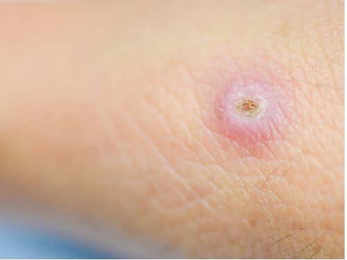 Paiseiden hoito 7 kotivinkin avulla