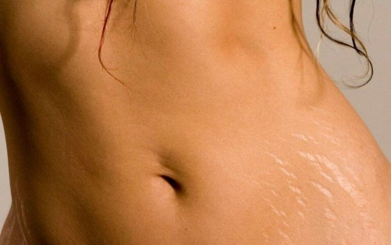 Some figure