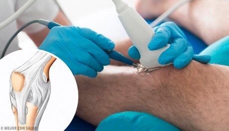 polven tähystysleikkaus