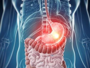 Tavallisimmat ruokaintoleranssit