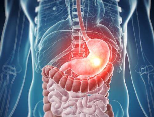 Tavallisimmat ruokaintoleranssit