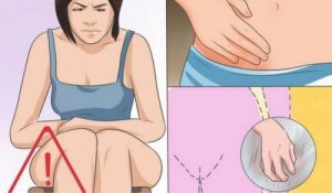 Emättimen hiivatulehdus - syyt, oireet ja hoito