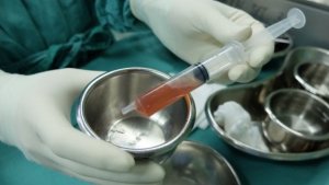 Askites: tietoa ja hoitomenetelmät