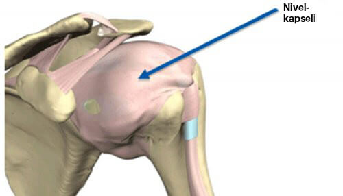 nivelkapseli