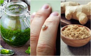 5 tehokasta keinoa syylien luonnolliseen eliminointiin