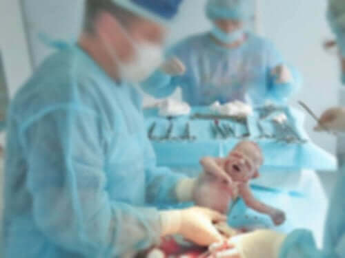 Jotkut vastasyntyneen sairaudet vaativat leikkausta