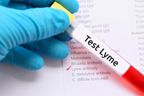 Lymen tauti voidaan todeta ELISA-nimisellä verikokeella