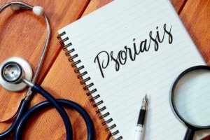 Ehkäise psoriaasia näillä viidellä tavalla
