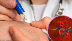 Lymen taudin oireet ja hoito