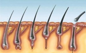 Mitä ovat pilomatriksoomat?