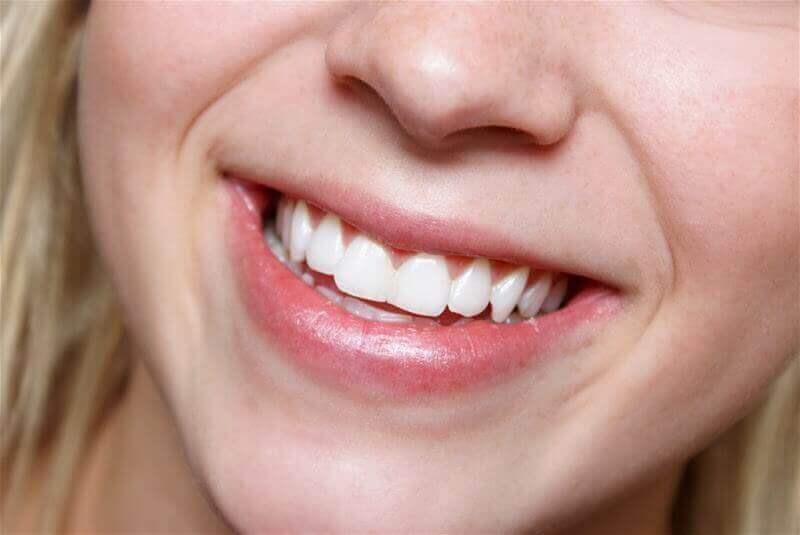Valkoiset hampaat