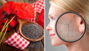 Vartalon kuorintavoiteet kuivalle iholle: 7 hyvää ideaa