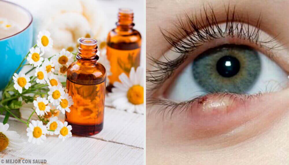 Näärännäpyn hoito: 5 helppoa vinkkiä