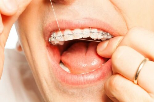 hammaslangan tulisi olla välttämätön osa hampaiden säännöllistä puhdistusta niin oikomishoidon aikana kuin normaalissa hampaiden puhdistusrutiinissa