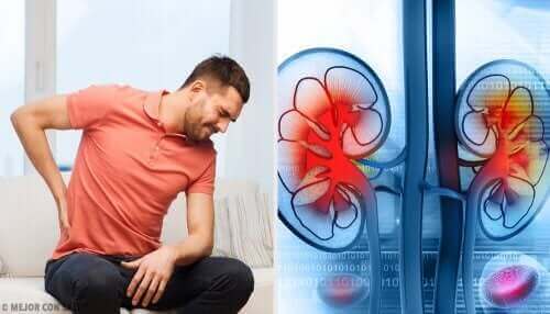 Munuaispaiseet voivat aiheuttaa kipua selässä