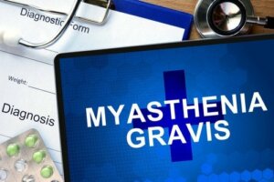 Myasthenia gravis: millainen sairaus on kyseessä?