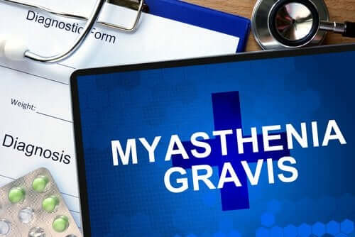 Myasthenia gravis: millainen sairaus on kyseessä?