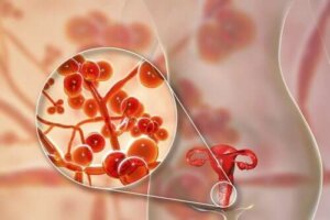 Mycoplasma genitalium: syyt, oireet ja hoito