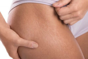 Tee itse raskausarpivoide E-vitamiinista