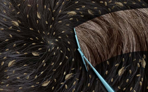 Naarastäit tuottavat erittäin vahvaa liimaa, jonka ansiosta saivareet pysyvät lujasti paikallaan niin, että niitä ei voida poistaa hiuksista edes pesemällä tai raapimalla