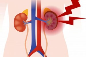 Vaskuliitit: mitä ne ovat ja miten ne voidaan luokitella?