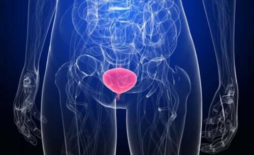 Virtsatietulehduksen oireet vaihtelevat paljolti sen mukaan, missä päin virtsajärjestelmää tulehdus ilmenee