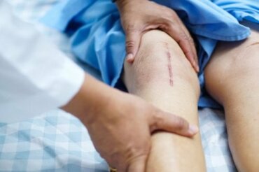 Polven tekonivelen asettaminen ja siitä toipuminen