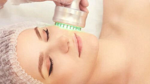 Radiotaajuutta hyödyntävä menetelmä on innovatiivinen ihon nuorentamiseen suunnattu tekniikka, joka vähentää kehon ja kasvojen ihon velttoutta