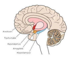 Liikehäiriöt: atetoosi