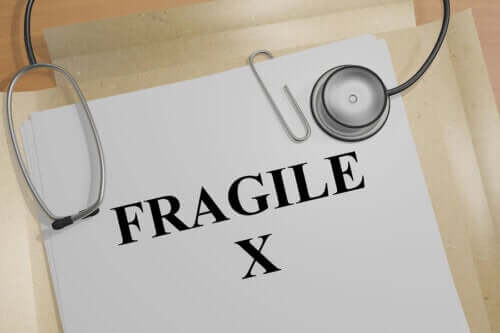 Fragile X-oireyhtymä: oireet ja hoito