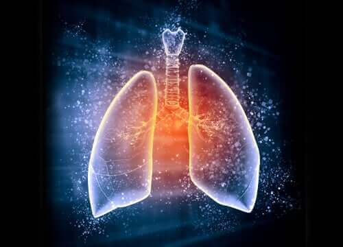 Keuhkoödeemassa keuhkorakkuloihin kulkeutuu nestettä hapen sijaan