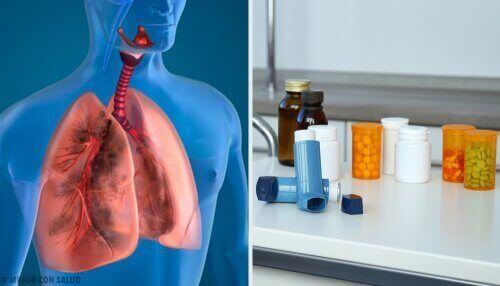 Sumutinhoidossa lääkeaine muutetaan hienojakoiseksi sumuksi, joka hengitetään keuhkoihin