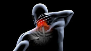 Lihassupistuksen ehkäisy ja hoito