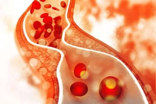 Carobjauhe auttaa alentamaan veren kolesterolia
