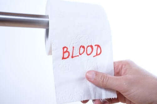 Mistä peräaukon verenvuoto johtuu?