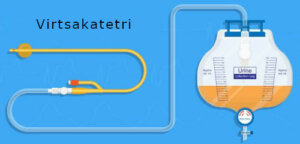 Synnytyksen jälkeinen virtsaumpi ja sen hoito