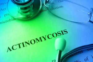 Aktinomykoosi: syyt, diagnoosi ja hoito