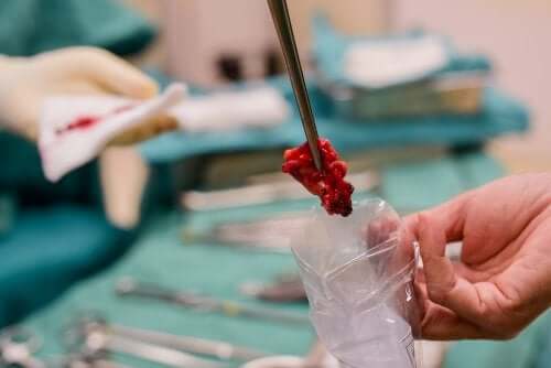 Tehokkuudestaan huolimatta kudoksesta otettu solunäyte ei aina ole paras mahdollinen menetelmä kasvaimen ominaisuuksien määrittämiseksi