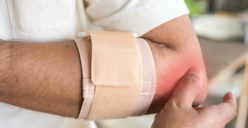 Ortopedisia laitteita ja tukia voidaan joissakin tapauksissa suunnata myös niille potilaille, jotka kärsivät bursiitista