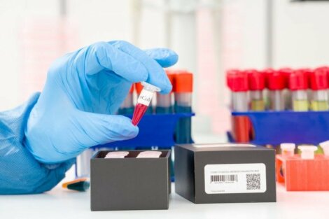 Koronaviruksen toteaminen: mikä on PCR-testi?