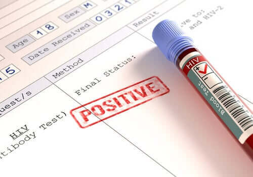 Onko koronavirus vaarallisempi HIV-positiivisille?