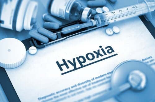 Aivojen hypoksia - tyypit ja aiheuttajat