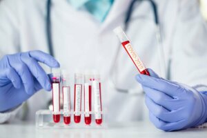 Mitä merkitystä veriryhmällä on koronaviruksen kannalta?