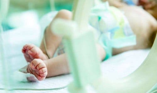 Gastroskiisi voidaan diagnosoida vauvalla jo ennen syntymää