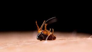 Tungiaasi: oireet ja hoito